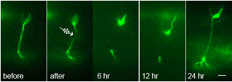 Nerve regeneration studies in Caenorhabditis elegans